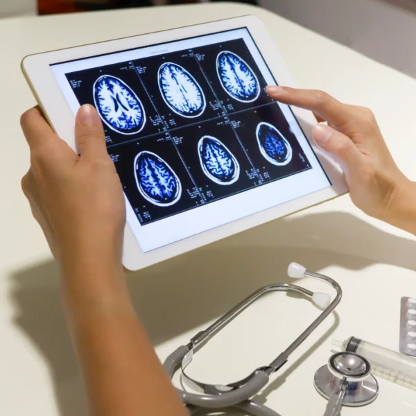 2 hands holding a tablet with brain scans on it.